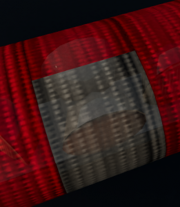 2d.png