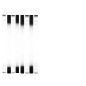 Leaf_Springs.png